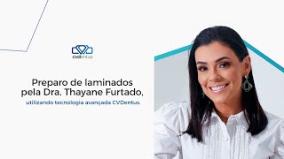 Dra. Thayane Furtado | Preparo de laminados com CVDentus