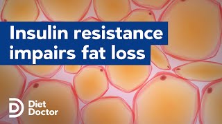 Insulin resistance impairs fat loss