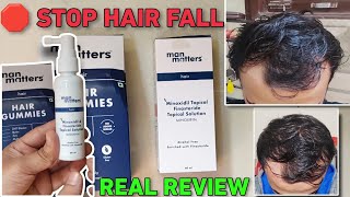 DO THIS BEFORE IT'S TOO LATE | MAN MATTERS MINOXIDIL REVIEW | HAIR GUMMIES | STOP HAIR FALL