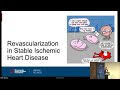 the 2021 coronary revascularization guidelines updates u0026 controversies madeline mahowald md