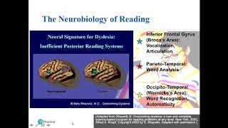 Assessment Solutions for Dyslexia Screening