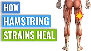 Hamstring Strain Healing - How Your Body Heals A Hamstring Strain