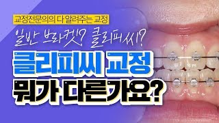 클리피씨 교정 완벽 정리 [이종국원장의 다 알려주는 교정]