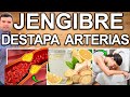 AGUA DE JENGIBRE EN AYUNAS PARA TODO! - Para Que Sirve? - Beneficios Para Tu Salud