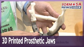 ITRI, Kaohsiung Veterans General Hospital unveil 3D printed prosthetic jaws｜Taiwan News