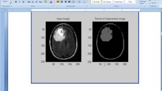 TSYS MEDICAL IMAGE PROCESSING MATLAB PROJECTS