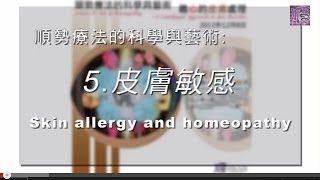 順勢療法的科學與藝術：5.皮膚敏感 (Skin allergy and homeopathy)