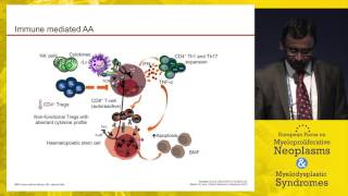 Hypocellular MDS vs. aplastic anemia - Diagnosis and therapy