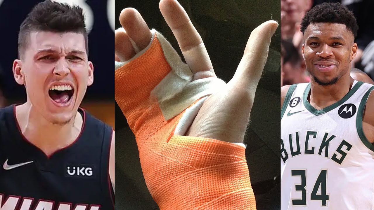 BREAKING MIAMI HEAT NEWS!! TYLER HERRO BROKE HIS RIGHT HAND VS THE ...