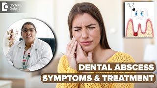 Abscessed Tooth | Pus in Tooth | Dental Infection - Dr. Karthika Krishna Kumar| Doctors' Circle