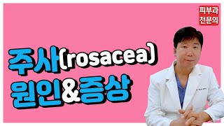 주사(rosacea) - 주사의 원인\u0026증상[명동고운세상피부과]