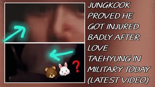 OMG😱💋Jungkook Proved He Got Injured Badly After Love Taehyung In Military(New)#taehyung#jungkook#bts