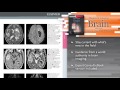 Diagnostic Imaging: Brain, 3rd Edition