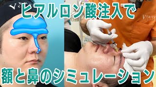 Dr.崔のアップデート企画　額と鼻のシミュレーション｜ヴェリテクリニック