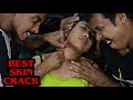 Best Skin Cracking | Girl Received Most Dangerous Cracks | Neck Cracking, Hair Cracking | ASMR