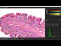 fast trainable image enhancement and nuclei detection histology