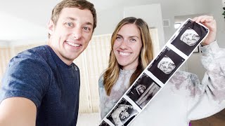 OUR FIRST ULTRASOUND!! IS IT TWINS? 8 WEEK ULTRASOUND