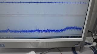 超音波プローブの伝搬特性を、測定・解析・評価技術（超音波システム研究所）