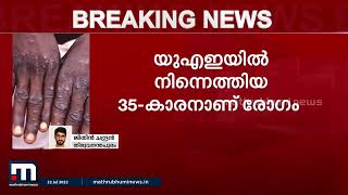 സംസ്ഥാനത്ത് ഒരാൾക്ക് കൂടി മങ്കിപോക്സ് | Mathrubhumi News |Monkeypox