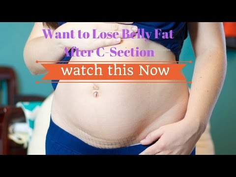 How to Lose Belly fat After C Section #NaturalRemedies How to Lose Belly fat After C Section #NaturalRemedies