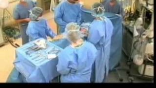 How Not to Perform the WHO Safe Surgery Checklist