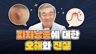 [오해와 진실] 잘못 알고 있었던 피지낭종! 제대로 알고 가자! (feat. 염증? 전염성? 피부색? 예방법?)