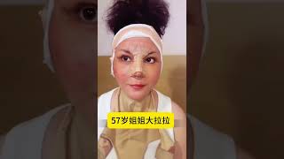 57岁姐姐大拉拉#整形 #医美 #facelift #plastic #大拉皮 #拉皮