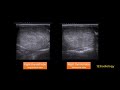 Ultrasound Case 09