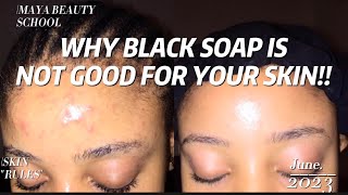 WHY BLACK SOAP IS NOT GOOD FOR YOUR SKIN!!! A MUST WATCH EDUCATING VIDEO.