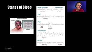 Lecture 6.7 - Sleep