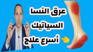 اخيرا علاج عرق النسا السياتيك (الانزلاق الغضروفي) التهاب العصب الوركي بطريقة طبيعية مجربة 2021