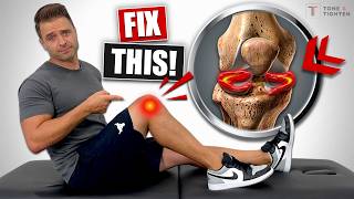 Fix Meniscus Tear Without Knee Surgery! [Pain Relief Exercises]