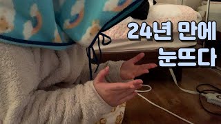 [VLOG] 드뎌 라섹했다..! | 1주일간 눈감고 생활한 후기 | 6개월 후기!