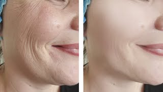 Just 1 Skin Tightening and Face lifting Home Remedy | Face Pack For Loose Facial Skin
