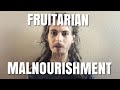 The Reason That I Look Like I’m Dying And Malnourished (Fruitarian Lifestyle)