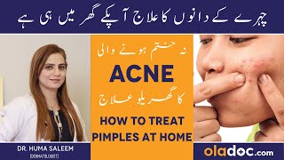 Acne Ka Gharelu Ilaj - Acne Treatment At Home In Urdu - Pimple Kaise Hataye - Dane Kaise Khatam Kare