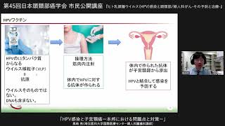 1　第45回日本頭頸部癌学会　市民公開講座　「HPV感染と子宮頸癌  本邦における問題点と対策 」