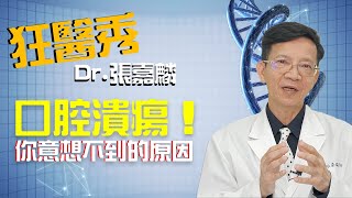 【狂醫秀】經常嘴巴破？一種你完全想不到的原因