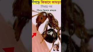 পিপড়া কিভাবে কামড়ায়🤔#fact #viral #viralvideo #trending #trendingshorts #youtubeshorts #youtube