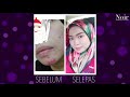 TESTIMONI NOIR SKINCARE   JERAGAT & JERAWAT HILANG SEAWAL 2 MINGGU