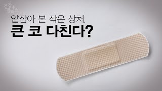 함부로 긁지 마세요!  작은 상처가 불러온 감염질환, 봉와직염 [건강플러스]