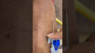 LOCATING DIFFICULT VEINS FOR IV CANNULATION | IV CANNULA