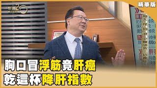 胸口冒「浮筋」竟 肝癌！乾這杯降肝指數！20240309【聚焦2.0】第527集