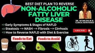 Fatty Liver: Early Symptoms, Stages & Detox Diet Plan | How to Detox Your Liver & Reverse NAFLD