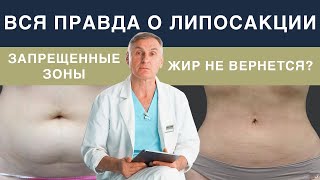 ЛИПОСАКЦИЯ ЖИВОТА, БЕДЕР ❗КАК УБРАТЬ ЖИР БЕЗОПАСНО, БЫСТРО И НАДОЛГО