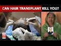 Can You Die Of Hair Transplant Surgery? Doctors Explain