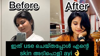 ഇത് use ചെയ്തപ്പോ എനിക്കി നല്ല result കിട്ടി guyzz👌#malayalmvlog #skincare #utubevideo