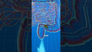 What Happens During Constipation? 💩
