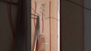 Let’s learn continuous suture technique 🪡 #sutures #surgeon