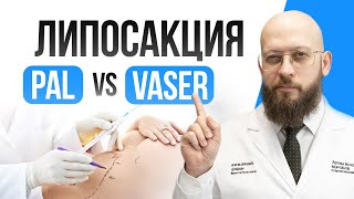 Всё про методы липосакции | PAL или VASER? | Какой метод липосакции лучше? | Пал или вэйзер?